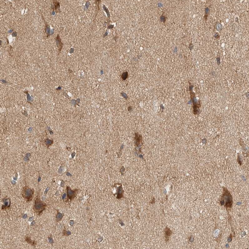 PXK Antibody - BSA Free Immunohistochemistry-Paraffin: PXK Antibody - BSA Free [NBP1-83663]