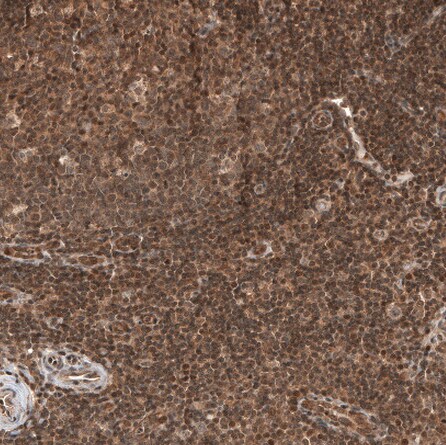 Otubain-1 Antibody - BSA Free Immunohistochemistry-Paraffin: Otubain-1 Antibody - BSA Free [NBP1-83670]