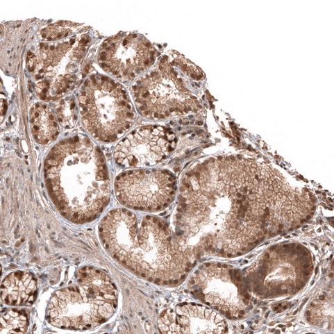 Otubain-1 Antibody - BSA Free Immunohistochemistry-Paraffin: Otubain-1 Antibody - BSA Free [NBP1-83670]