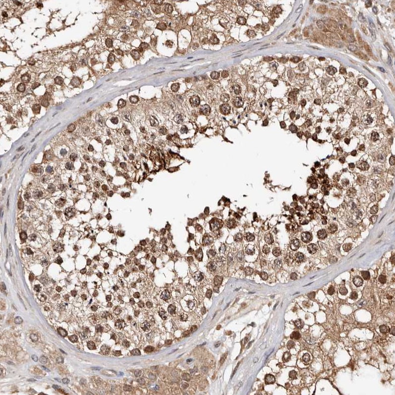 WEE2 Antibody - BSA Free Immunohistochemistry-Paraffin: WEE2 Antibody - BSA Free [NBP1-83676]
