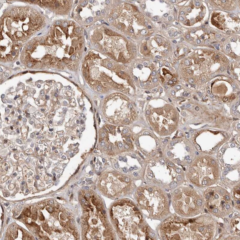 WEE2 Antibody - BSA Free Immunohistochemistry-Paraffin: WEE2 Antibody - BSA Free [NBP1-83676]