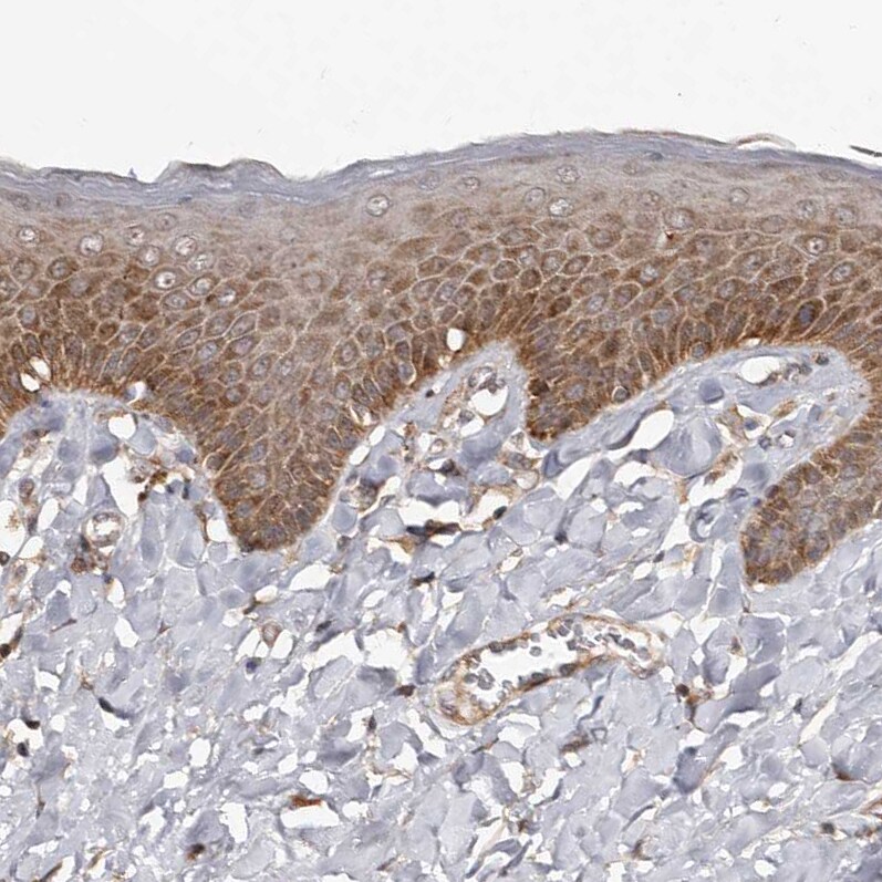 WEE2 Antibody - BSA Free Immunohistochemistry-Paraffin: WEE2 Antibody - BSA Free [NBP1-83676]