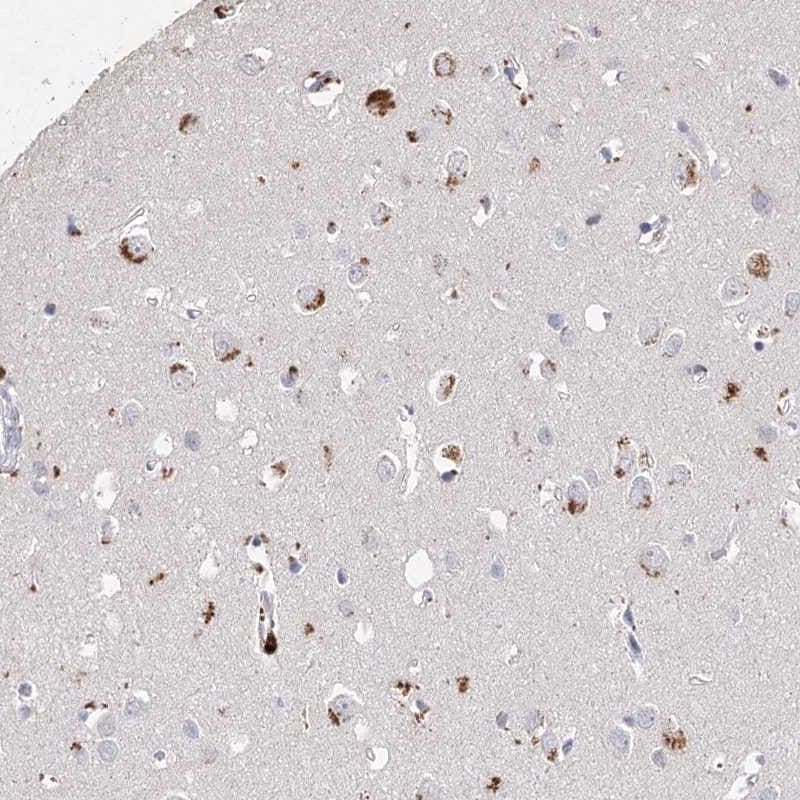 ARSI Antibody - BSA Free Immunohistochemistry: ARSI Antibody - BSA Free [NBP1-83678]