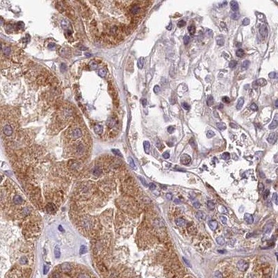SPRYD3 Antibody - BSA Free Immunohistochemistry-Paraffin: SPRYD3 Antibody [NBP1-83681]