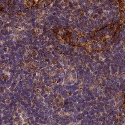 SPRYD3 Antibody - BSA Free Immunohistochemistry-Paraffin: SPRYD3 Antibody [NBP1-83681]
