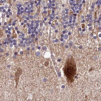 SPRYD3 Antibody - BSA Free Immunohistochemistry-Paraffin: SPRYD3 Antibody [NBP1-83681]