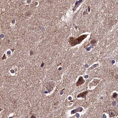 SPRYD3 Antibody - BSA Free Immunohistochemistry-Paraffin: SPRYD3 Antibody [NBP1-83681]