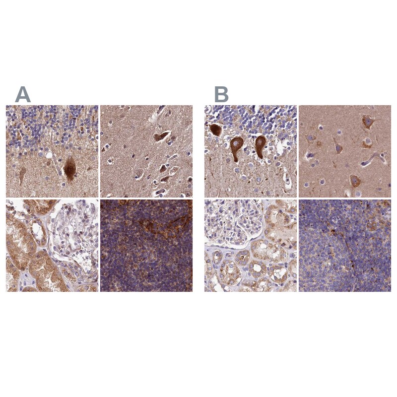 SPRYD3 Antibody - BSA Free Immunohistochemistry-Paraffin: SPRYD3 Antibody [NBP1-83681]