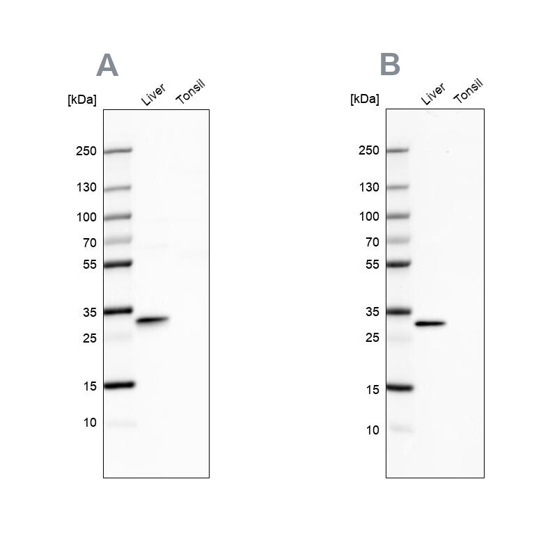 PBLD Antibody - BSA Free Western Blot: PBLD Antibody - BSA Free [NBP1-83682]