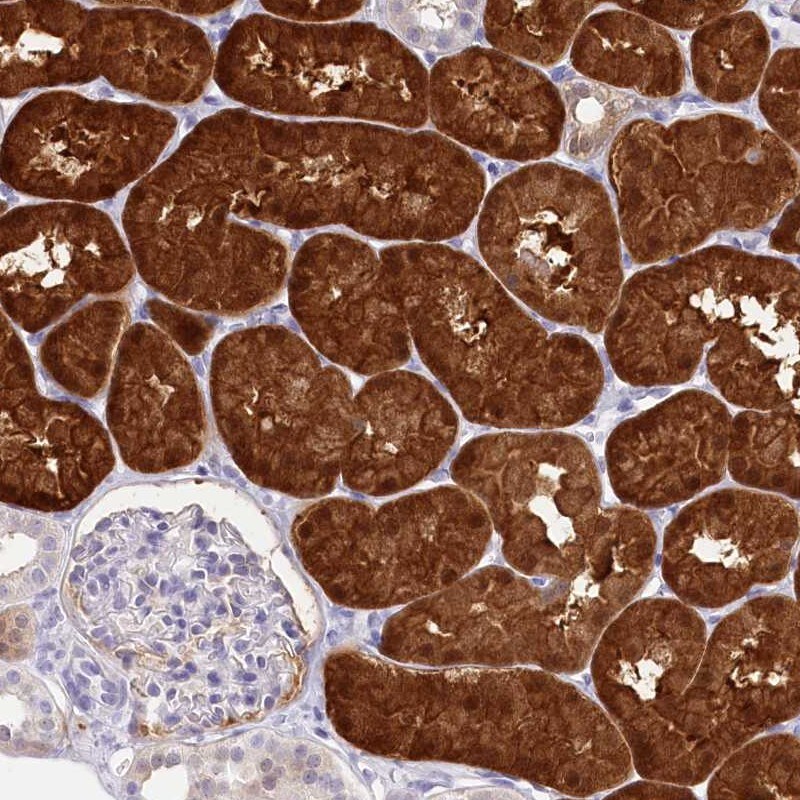 PBLD Antibody - BSA Free Immunohistochemistry-Paraffin: PBLD Antibody - BSA Free [NBP1-83683]