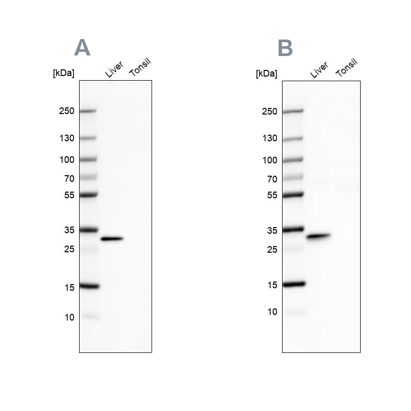 PBLD Antibody - BSA Free Western Blot: PBLD Antibody - BSA Free [NBP1-83683]