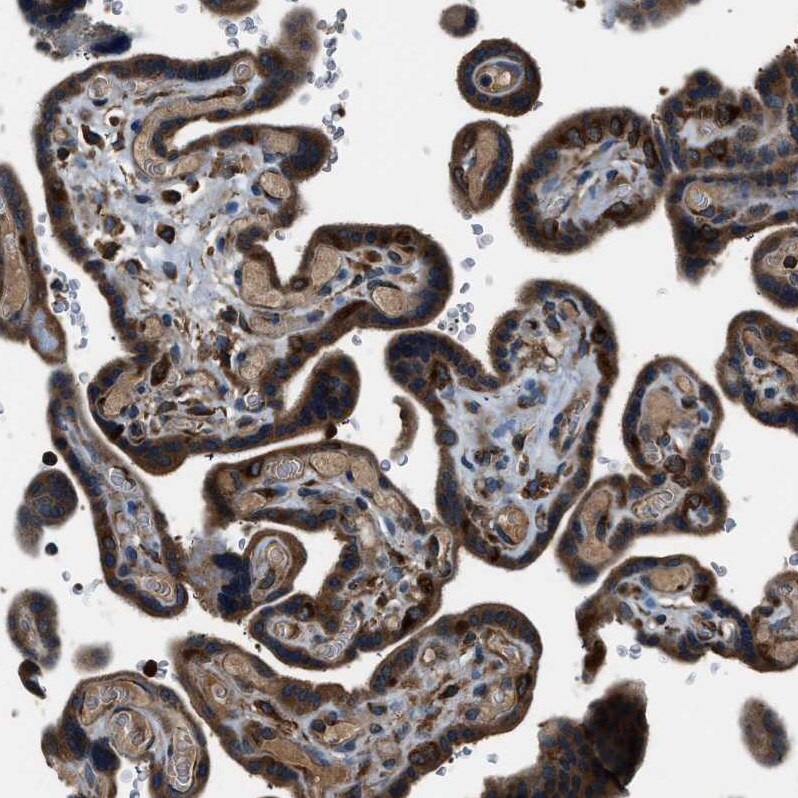 ARFGAP2 Antibody - BSA Free Immunohistochemistry-Paraffin: ARFGAP2 Antibody - BSA Free [NBP1-83688]