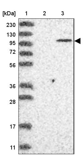 PARP10 Antibody - BSA Free Western Blot: PARP10 Antibody - BSA Free [NBP1-83689]