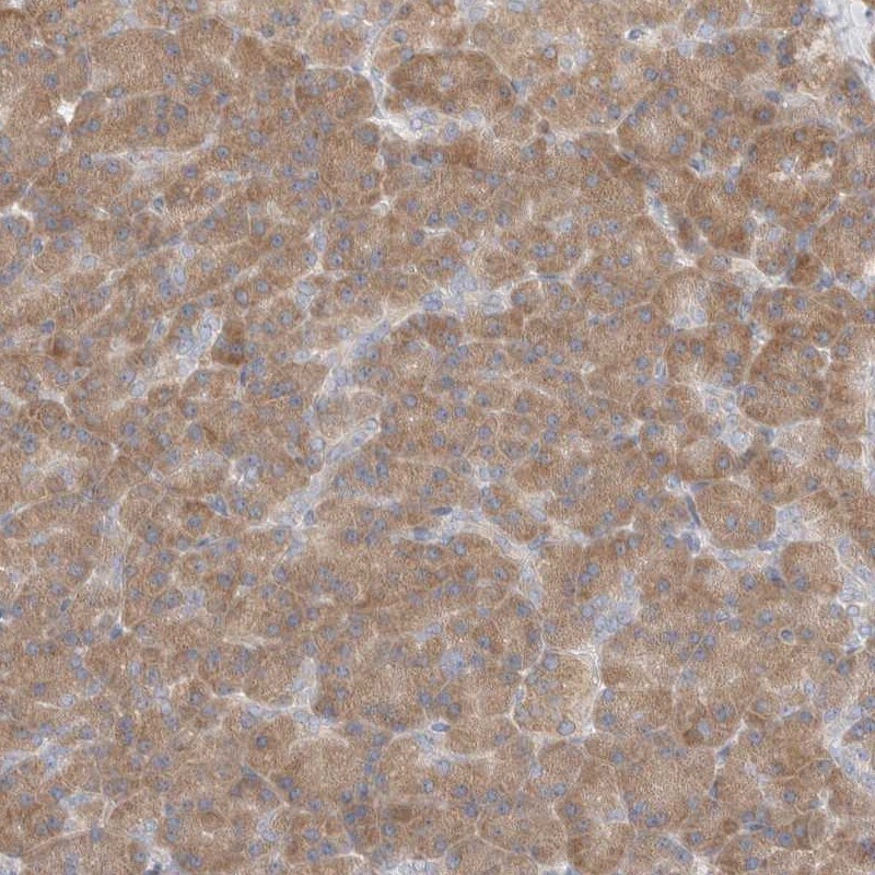 C16orf58 Antibody - BSA Free Immunohistochemistry-Paraffin: C16orf58 Antibody [NBP1-83692]