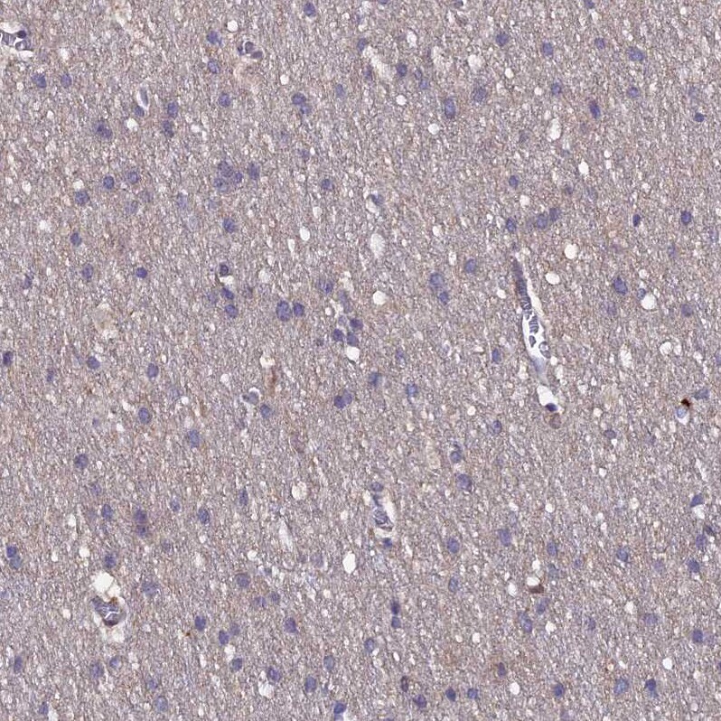 TMC5 Antibody - BSA Free Immunohistochemistry-Paraffin: TMC5 Antibody - BSA Free [NBP1-83696]