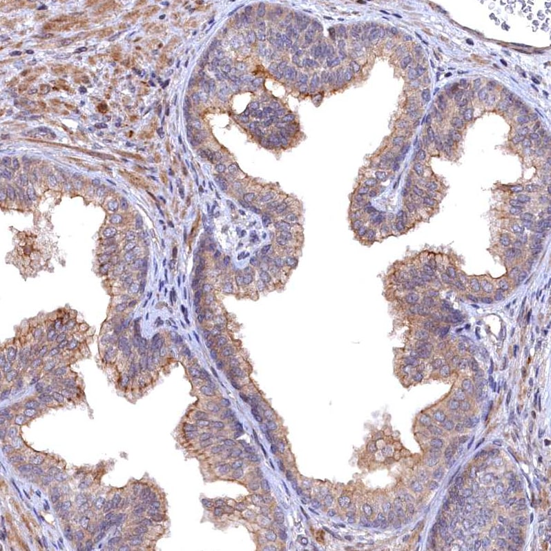 TMC5 Antibody - BSA Free Immunohistochemistry-Paraffin: TMC5 Antibody - BSA Free [NBP1-83696]