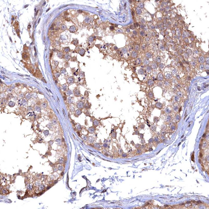 TMC5 Antibody - BSA Free Immunohistochemistry-Paraffin: TMC5 Antibody - BSA Free [NBP1-83696]