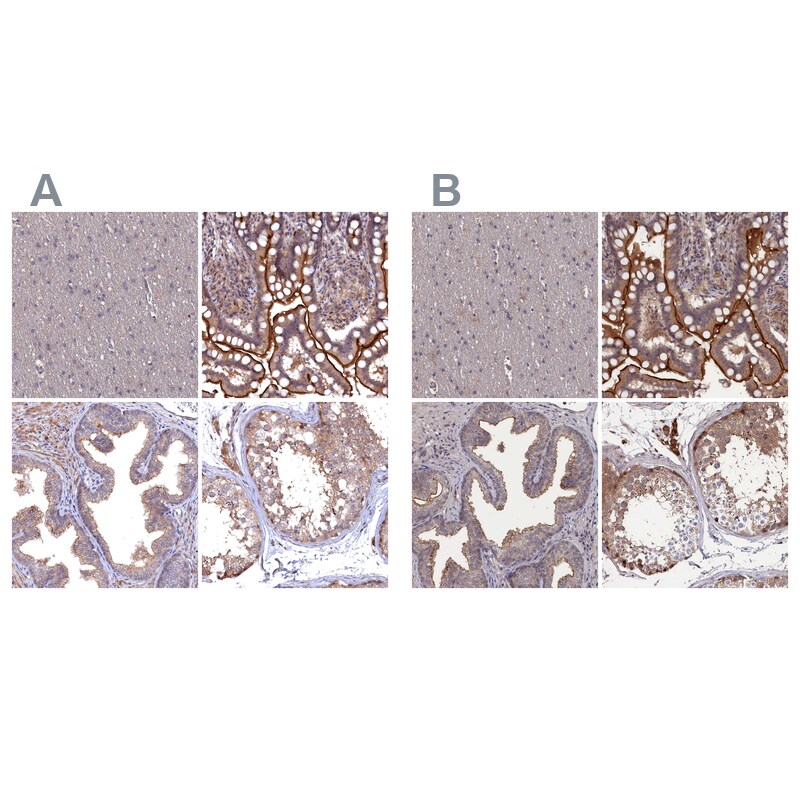 TMC5 Antibody - BSA Free Immunohistochemistry-Paraffin: TMC5 Antibody - BSA Free [NBP1-83696]