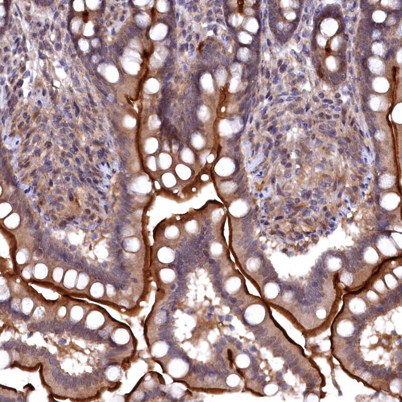 TMC5 Antibody - BSA Free Immunohistochemistry-Paraffin: TMC5 Antibody - BSA Free [NBP1-83696]