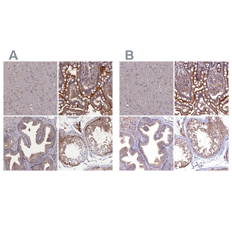 TMC5 Antibody - BSA Free Immunohistochemistry-Paraffin: TMC5 Antibody - BSA Free [NBP1-83697]