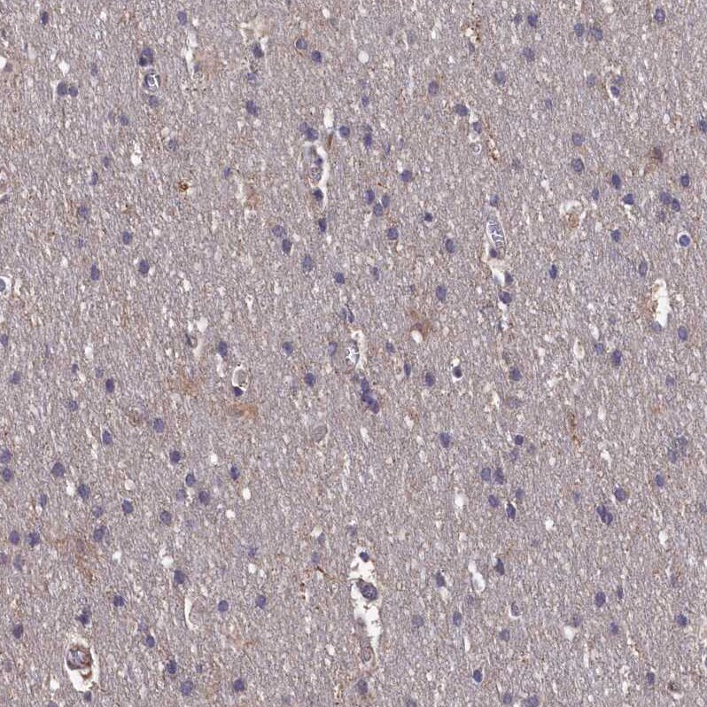 TMC5 Antibody - BSA Free Immunohistochemistry-Paraffin: TMC5 Antibody - BSA Free [NBP1-83697]