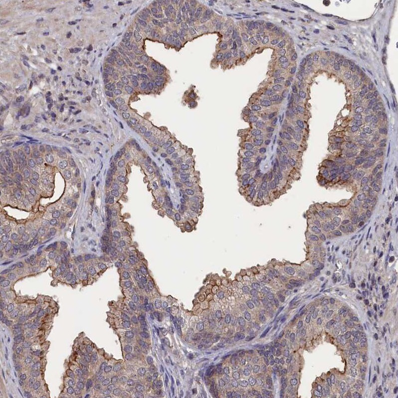TMC5 Antibody - BSA Free Immunohistochemistry-Paraffin: TMC5 Antibody - BSA Free [NBP1-83697]