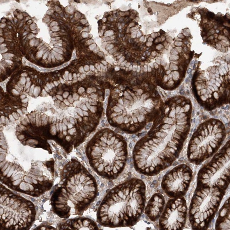 SMAP1 Antibody - BSA Free Immunohistochemistry-Paraffin: SMAP1 Antibody [NBP1-83702]