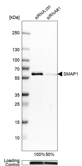 SMAP1 Antibody - BSA Free Western Blot: SMAP1 Antibody - BSA Free [NBP1-83702]