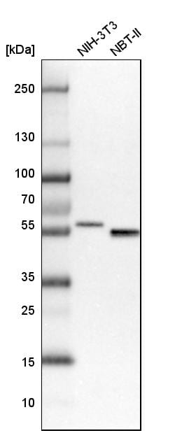 SMAP1 Antibody - BSA Free Western Blot: SMAP1 Antibody - BSA Free [NBP1-83702]