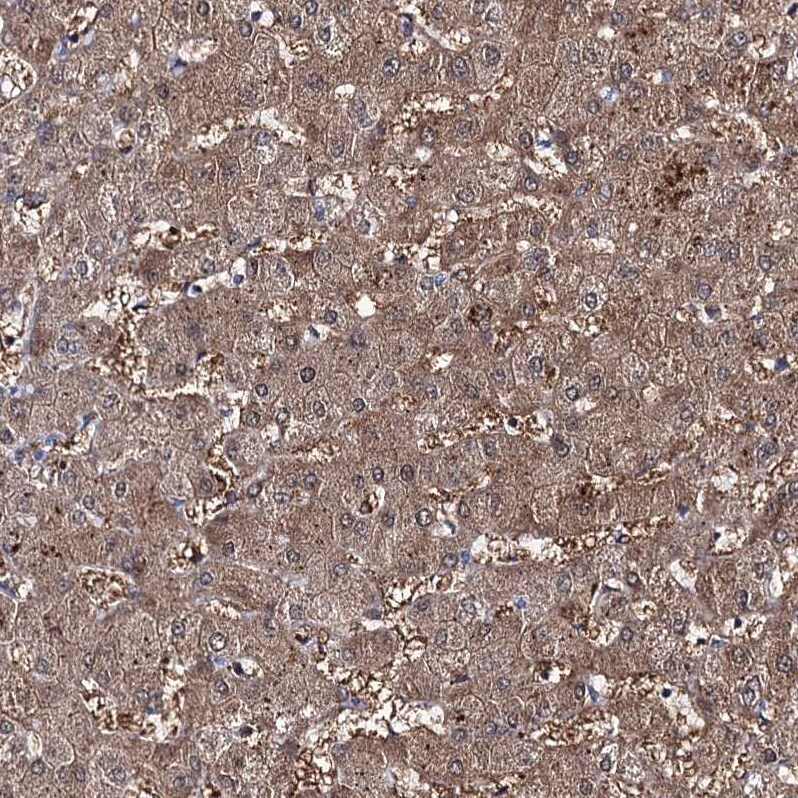CLPB Antibody - BSA Free Immunohistochemistry-Paraffin: CLPB Antibody - BSA Free [NBP1-83703]
