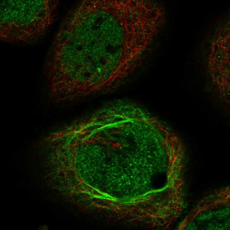 QTRTD1 Antibody - BSA Free Immunocytochemistry/ Immunofluorescence: QTRTD1 Antibody [NBP1-83706]