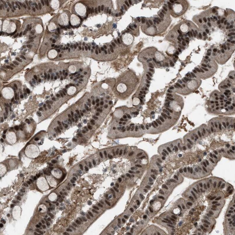 ZBTB10 Antibody - BSA Free Immunohistochemistry-Paraffin: ZBTB10 Antibody - BSA Free [NBP1-83714]
