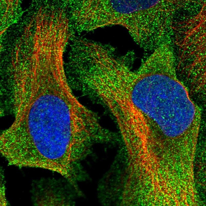 TTC23 Antibody - BSA Free Immunocytochemistry/ Immunofluorescence: TTC23 Antibody [NBP1-83718]