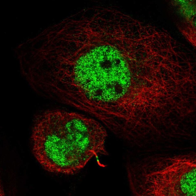 Kif4A Antibody - BSA Free Immunocytochemistry/ Immunofluorescence: Kif4A Antibody [NBP1-83720]