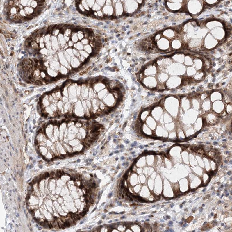 Kif4A Antibody - BSA Free Immunohistochemistry-Paraffin: Kif4A Antibody - BSA Free [NBP1-83721]