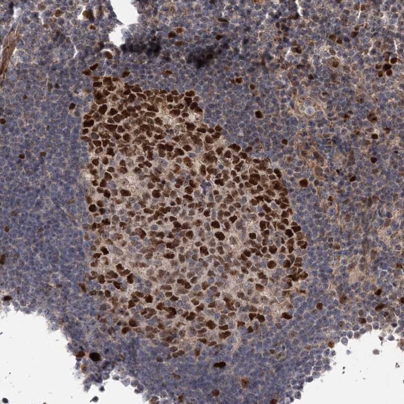 Kif4A Antibody - BSA Free Immunohistochemistry-Paraffin: Kif4A Antibody - BSA Free [NBP1-83721]