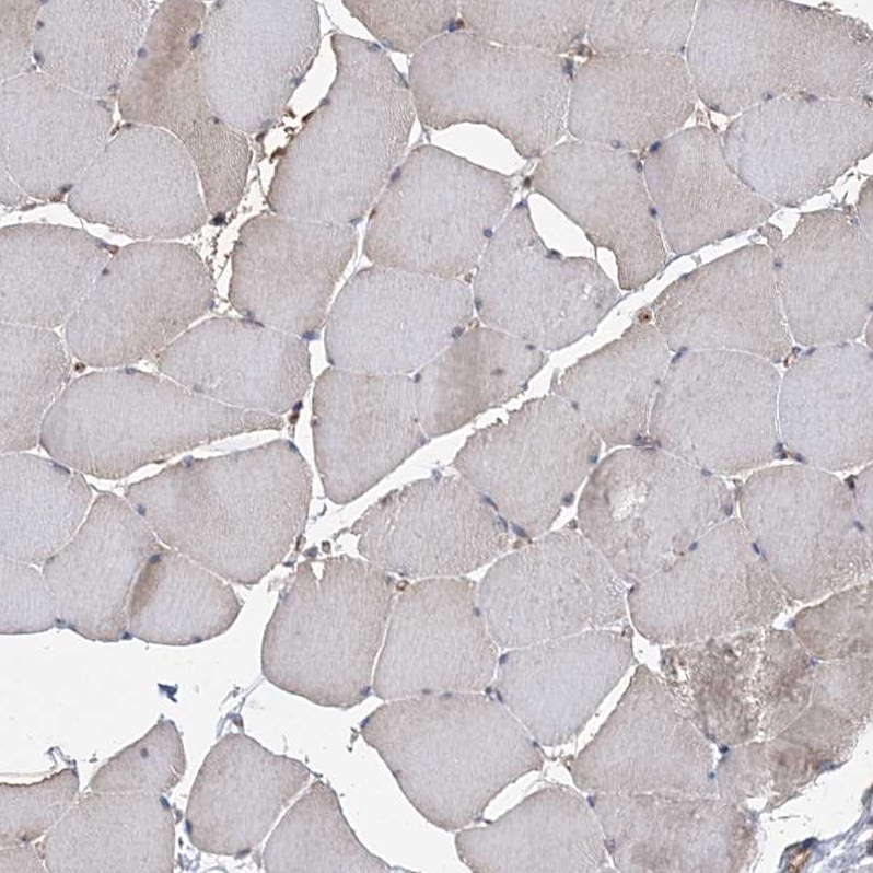 Kif4A Antibody - BSA Free Immunohistochemistry-Paraffin: Kif4A Antibody - BSA Free [NBP1-83721]