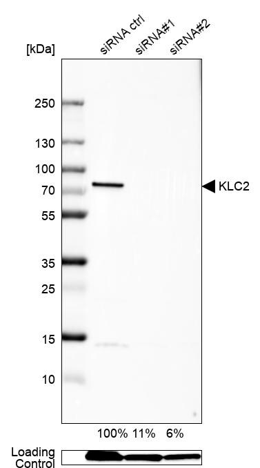 KLC2 Antibody - BSA Free Western Blot: KLC2 Antibody - BSA Free [NBP1-83723]