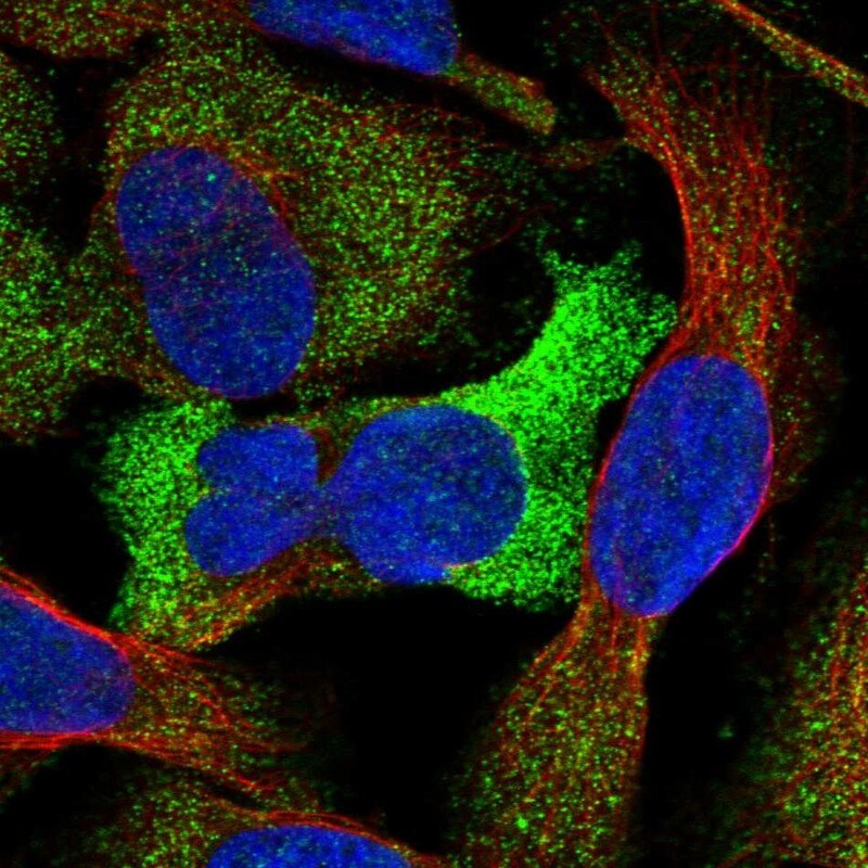 GTDC1 Antibody - BSA Free Immunocytochemistry/ Immunofluorescence: GTDC1 Antibody [NBP1-83725]