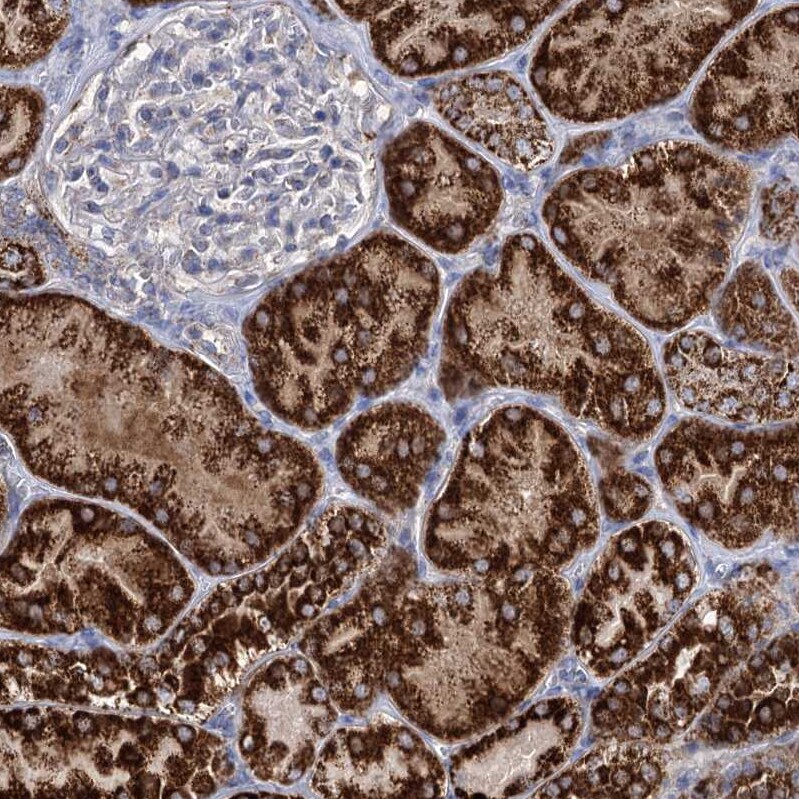 ABHD10 Antibody - BSA Free Immunohistochemistry-Paraffin: ABHD10 Antibody - BSA Free [NBP1-83748]
