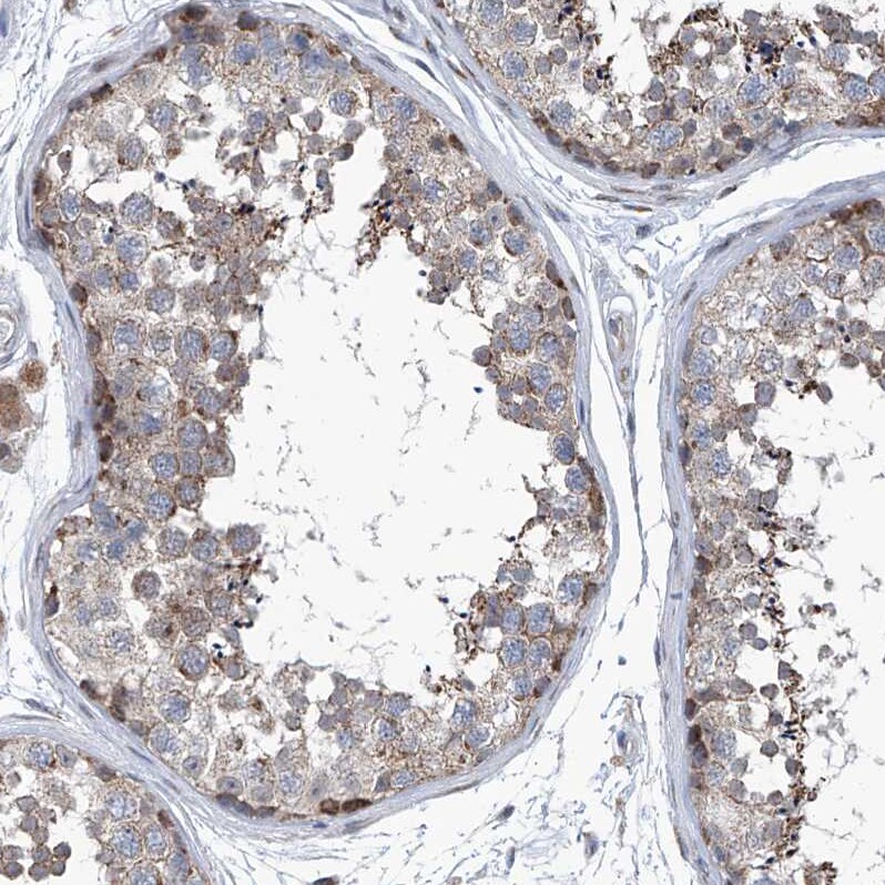 USP48 Antibody - BSA Free Immunohistochemistry-Paraffin: USP48 Antibody - BSA Free [NBP1-83751]