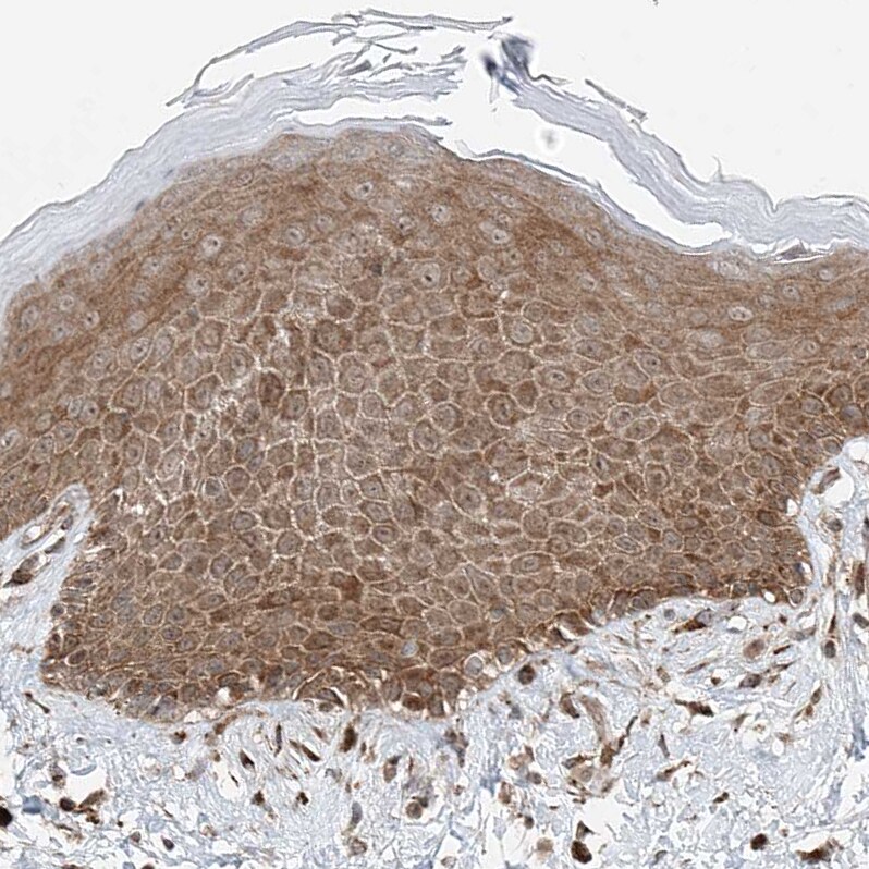 USP48 Antibody - BSA Free Immunohistochemistry-Paraffin: USP48 Antibody - BSA Free [NBP1-83752]