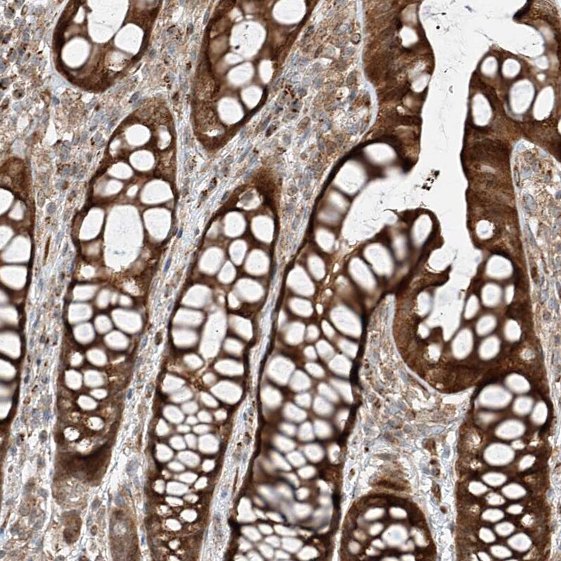 USP48 Antibody - BSA Free Immunohistochemistry-Paraffin: USP48 Antibody - BSA Free [NBP1-83752]