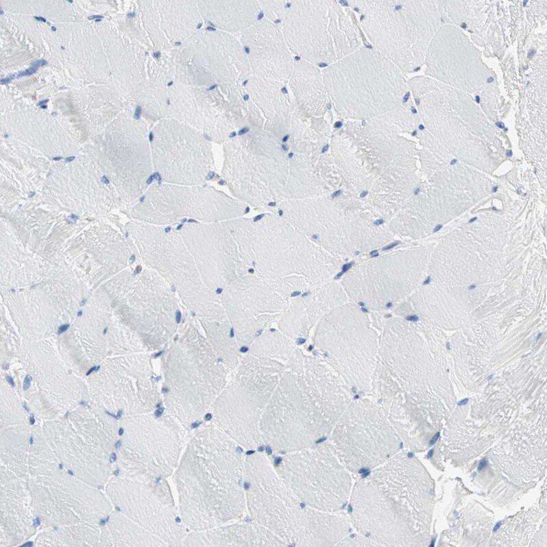 PLCXD1 Antibody - BSA Free Immunohistochemistry-Paraffin: PLCXD1 Antibody - BSA Free [NBP1-83753]