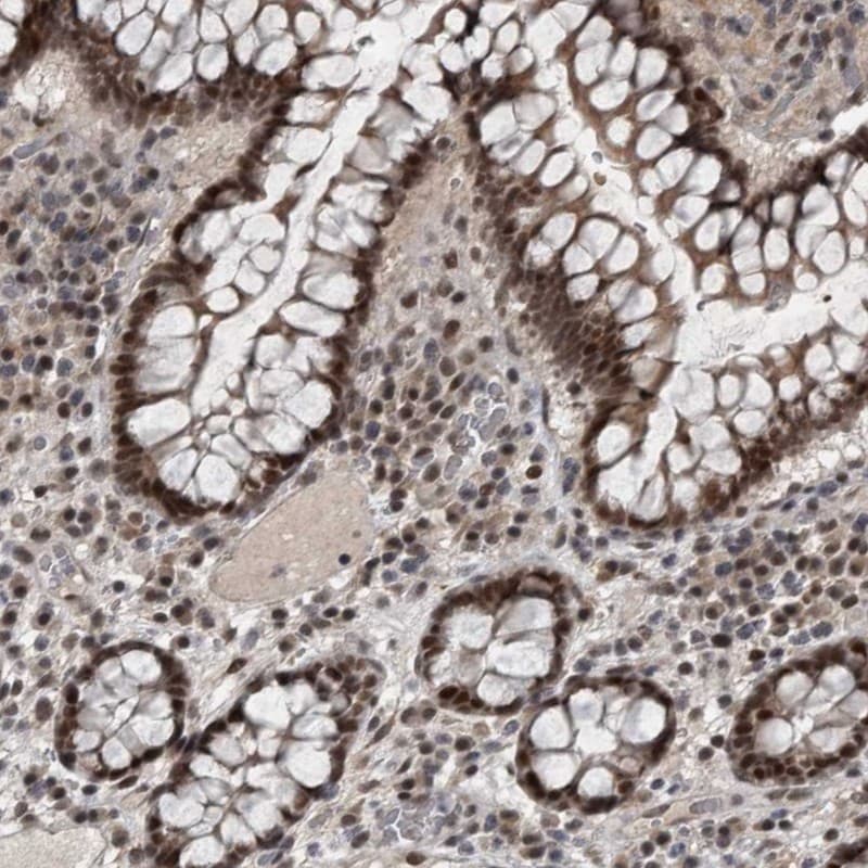 WDR33 Antibody - BSA Free Immunohistochemistry-Paraffin: WDR33 Antibody - BSA Free [NBP1-83756]