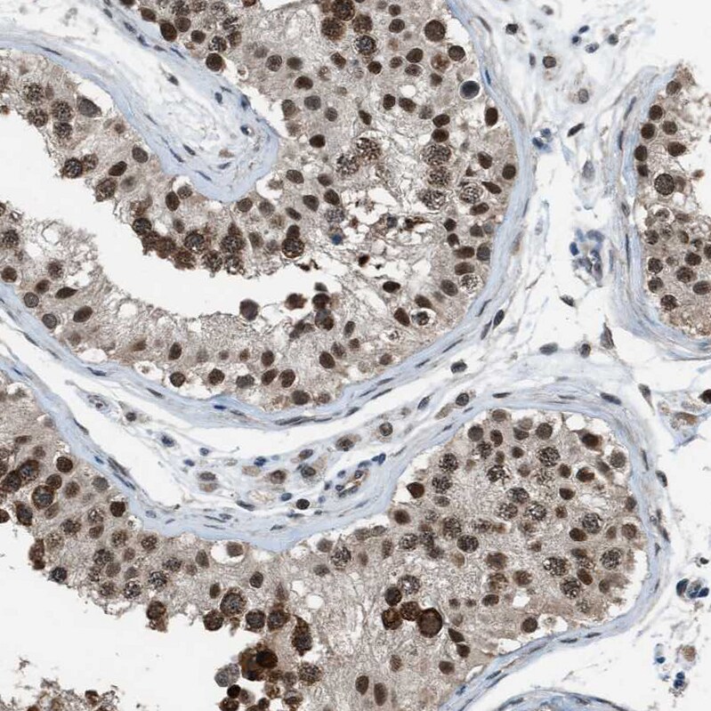 KPNA6 Antibody - BSA Free Immunohistochemistry-Paraffin: KPNA6 Antibody [NBP1-83762]