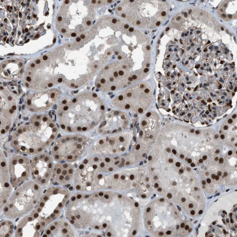 KPNA6 Antibody - BSA Free Immunohistochemistry-Paraffin: KPNA6 Antibody [NBP1-83762]