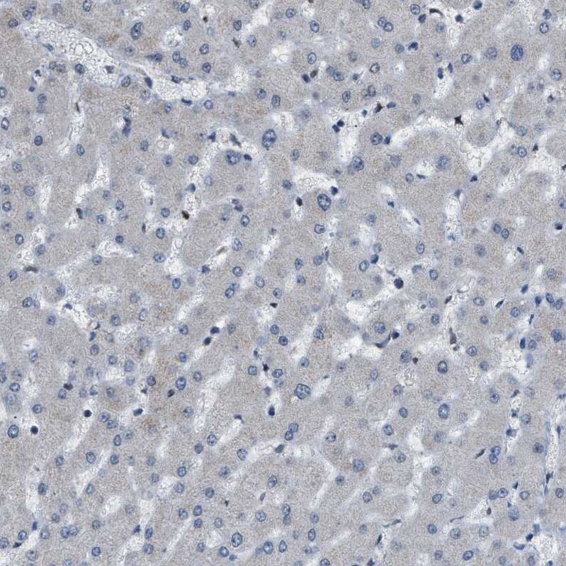 KPNA6 Antibody - BSA Free Immunohistochemistry-Paraffin: KPNA6 Antibody [NBP1-83762]