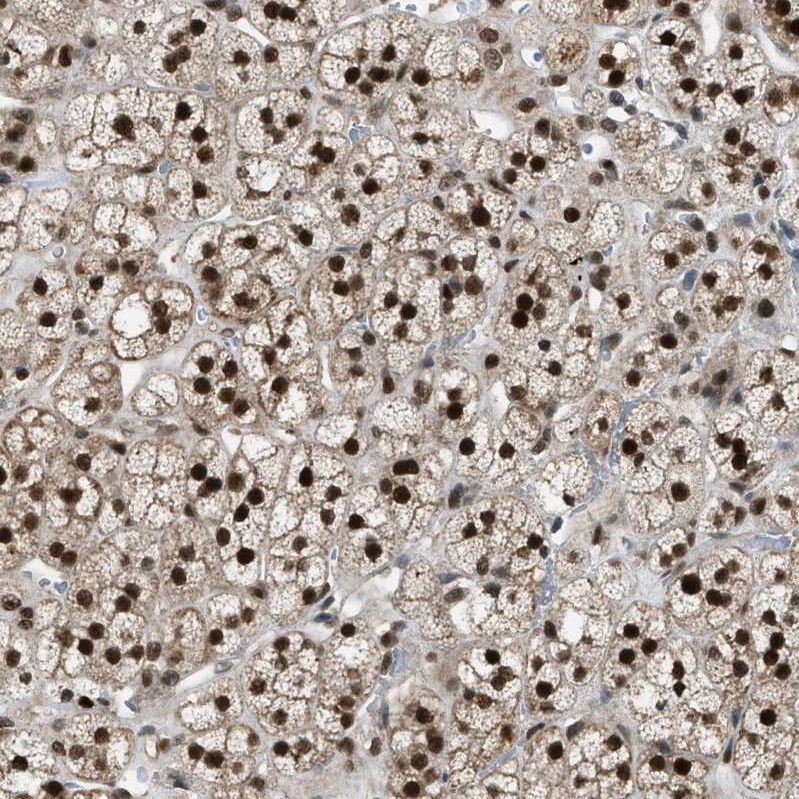 KPNA6 Antibody - BSA Free Immunohistochemistry-Paraffin: KPNA6 Antibody [NBP1-83762]