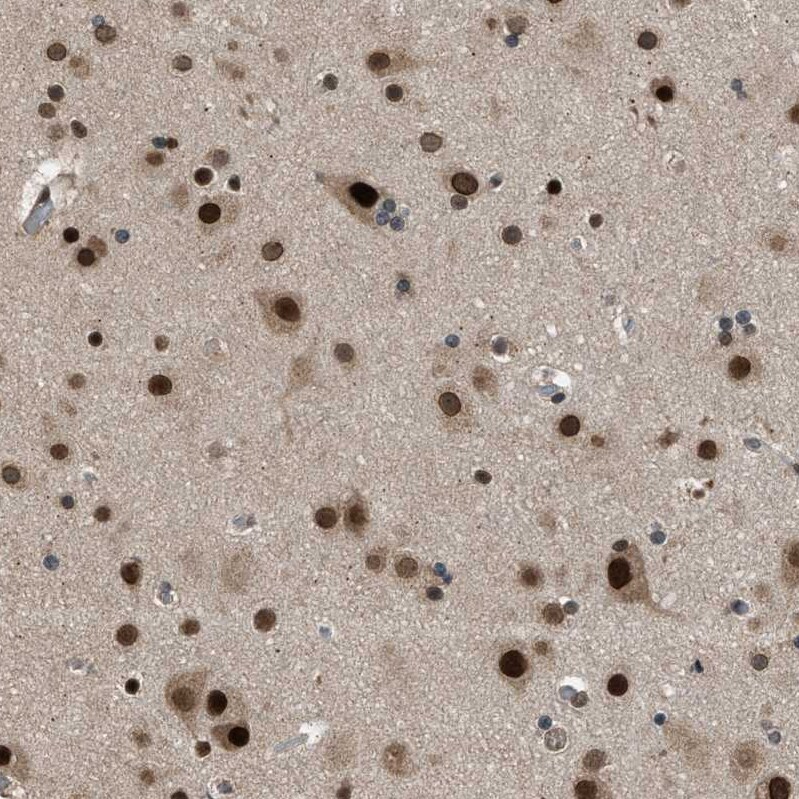 KPNA6 Antibody - BSA Free Immunohistochemistry-Paraffin: KPNA6 Antibody [NBP1-83762]